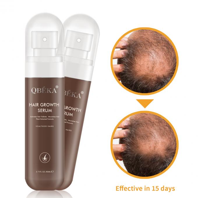 QBEKA Professional Hair Extension لوشن للاستجابة والإطعام في الشعر لمدة 15 يوما 2